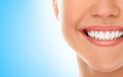 Care Tips After Teeth Whitening