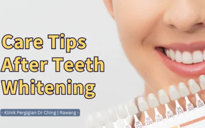 Care Tips After Teeth Whitening