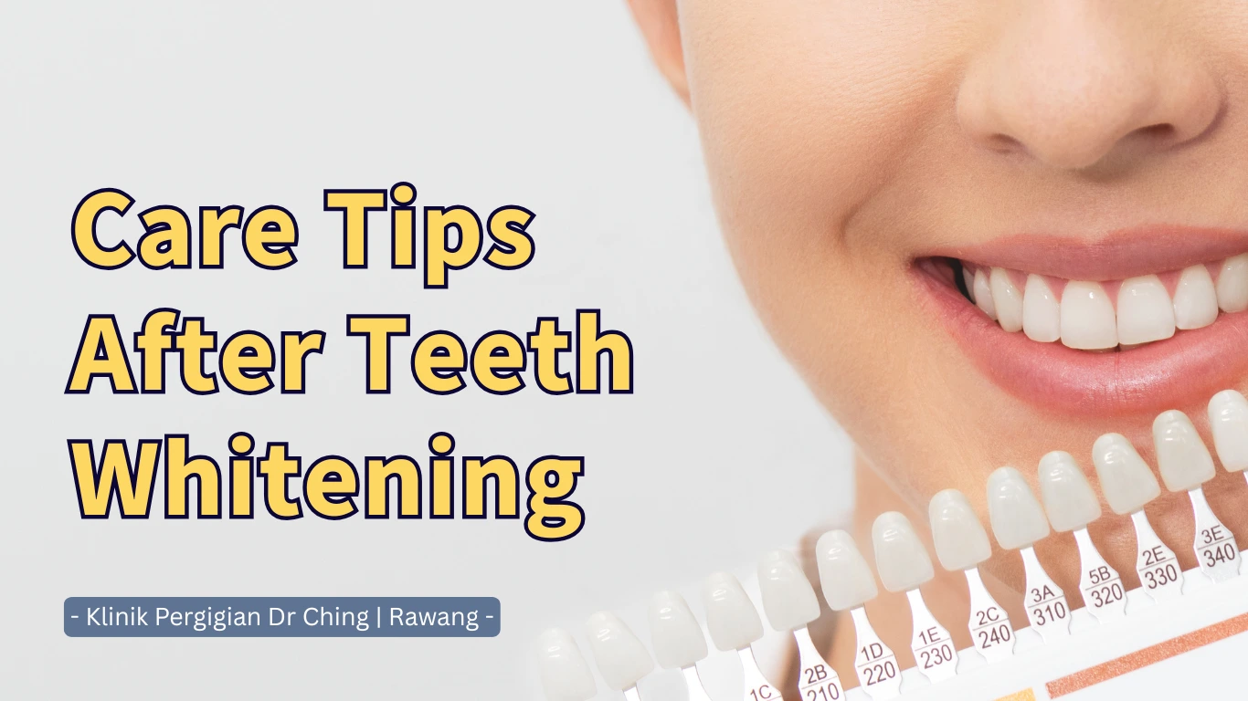 care tips after teeth whitening by dr ching dental clinic in rawang.