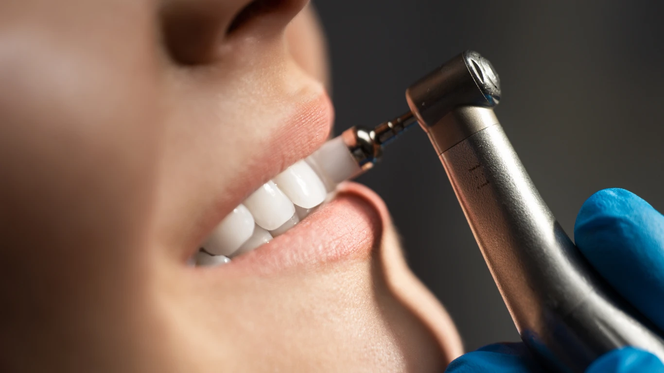 Teeth scaling and polishing service by Dr Ching, at Klinik Pergigian Dr Ching in Anggun City, Rawang.